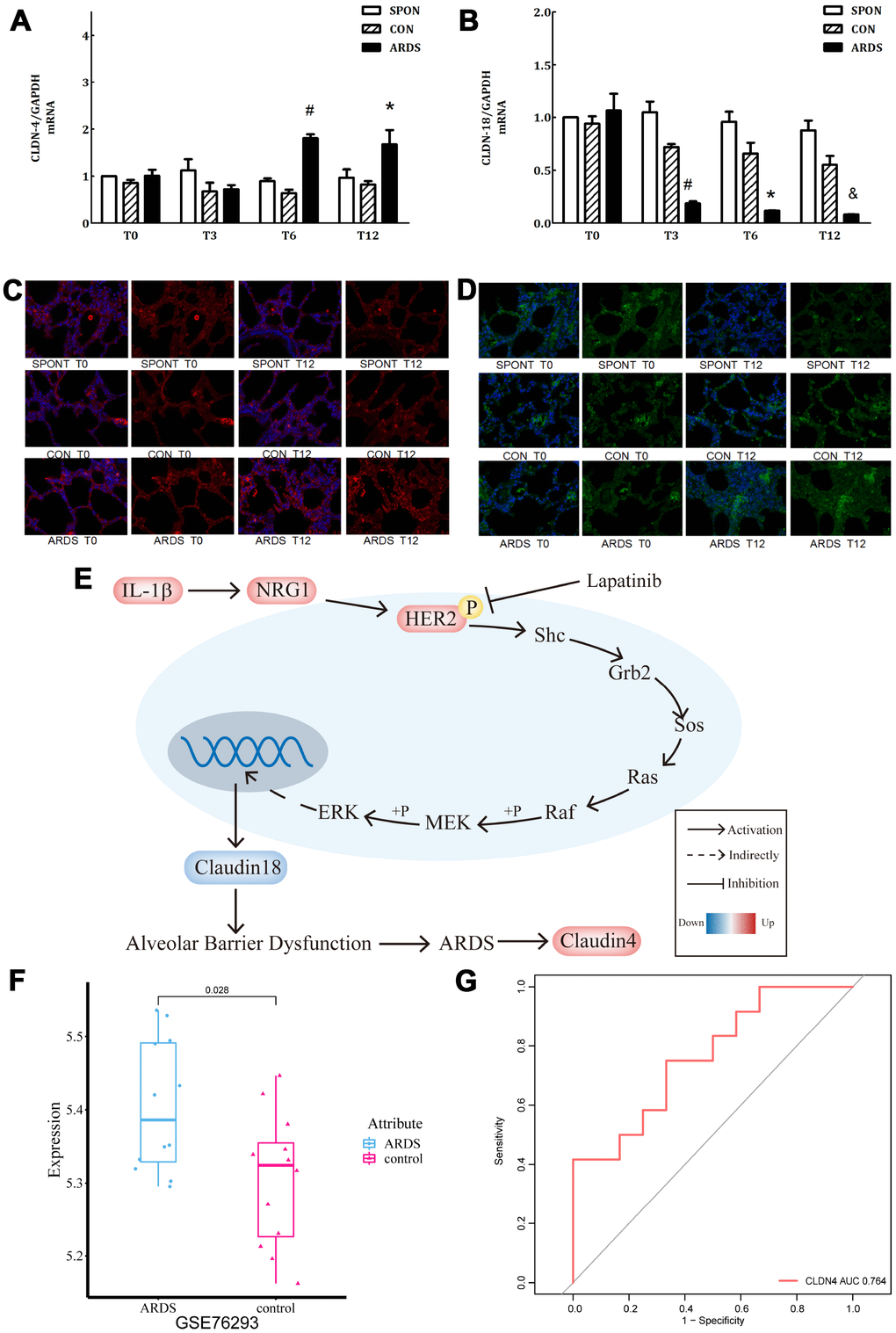 Further verification of claudin4/18 expression and localization in the ARDS model. (A) Comparison of expression levels of claudin4, claudin4 expression significantly increased at 8 hours and 12 hours in ARDS. (B) Claudin18 expression in lung tissue decreased significantly at 3 hours, 6 hours, and 12 hours of ARDS. (C). Three groups of 0, 3, 6 and 12 hours of lung tissue. Claudin4 immunofluorescence, purple fluorescence is the nucleus, red fluorescence is claudin4 protein, and the fluorescence and fluorescence intensity around the cells are compared. The fluorescence around the cells in the ARDS group was significantly stronger than that in the other groups at 12 hours. The expression of claudin4 protein was increased during the induction of lung tissue in the ARDS model. (D) The lung tissues of three groups at 0, 3, 6 and 12 hours showed immunofluorescence. The nucleus was stained with blue fluorescence and the protein was stained with red fluorescence. The 12-hour peripheral fluorescence of ARDS group was significantly weaker than that of other groups. During the induction of ARDS model, the expression of lung tissue decreased and the location of protein on cell membrane decreased; (E) IL-1β activated HER2 signaling pathway by up-regulating NRG1, which regulates the expression of claudin18 protein, promoting the development of ARDS. Furthermore, in turn, this would initiate a compensatory protective mechanism, promoting the expression of claudin4, strengthening the repair of lung barrier function. The series of reactions would be reversed by the addition of lapatinib, a HER2 blocker. (F) Claudin4 was up-regulated in ARDS compared to control in GSE76293. (G) ROC curve results indicated that claudin4 can distinguish ARDS and control in GSE76293.