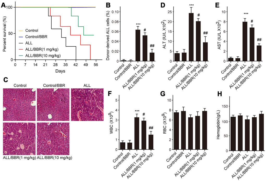 BBR extends the survival and attenuates the pathological conditions in ALL-transplanted xenograft mice. SCID mice, injected with either EU-4 cells or an equivalent volume of PBS via tail vein, were treated with BBR at 1 or 10 mg/kg (n=6 mice per group). (A) Kaplan-Meier survival curves showing the mortality of the mice. (B) Donor-derived ALL cells were analyzed by flow cytometry. (C) Representative images of H&E staining of liver tissues (magnification×). (D) The levels of alanine aminotransferase (ALT) and (E) aspartate aminotransferase (AST) in serum were measured. The number of (F) white blood cells (WBC) and (G) red blood cells (RBC) in blood. (H) Serum levels of hemoglobin. SCID mice, injected with wild-type (WT) or XIAP knockout EU-4 cells (XIAP-/-) via tail vein, were treated with 10 mg/kg BBR (n=6 mice per group). Results are expressed as mean ± SD. ***ppp