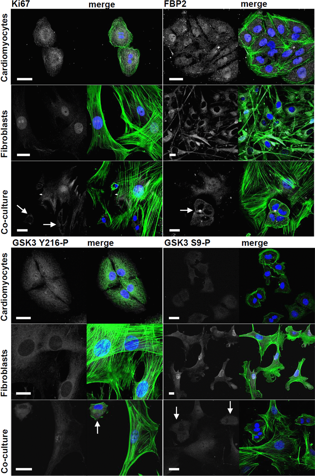 Changes in subcellular localization and immunostaining intensity of Ki-67, FBP2 and FBP2-regulating kinase GSK3 evoked by cardiomyocytes-fibroblasts co culture. On merged pictures actin appears as green and nuclei are shown in blue. White arrows point to cardiomyocytes. Bar = 20 μm.