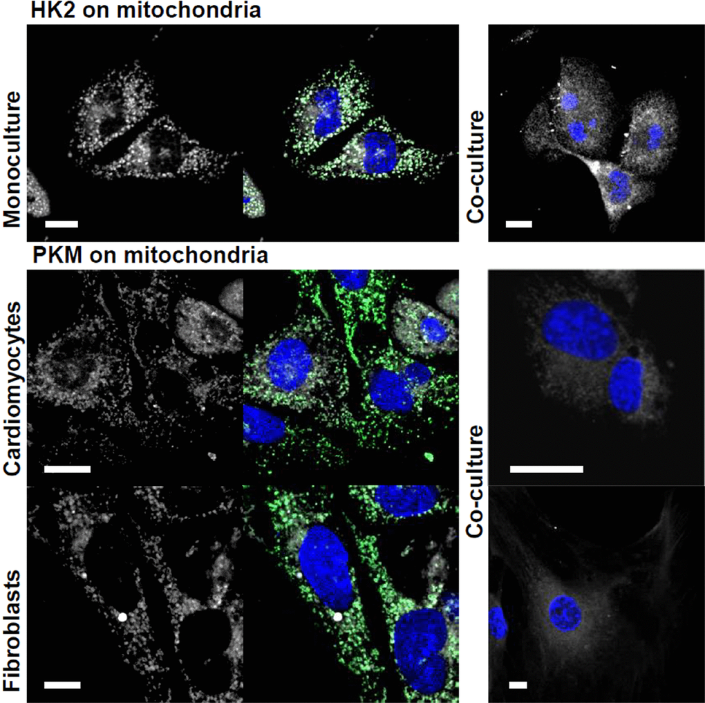 Co-culturing-induced changes in mitochondrial localization of HK2 and PKM. The studied proteins are shown in white, mitochondria – in green and nuclei – blue. Bar = 10 μm.