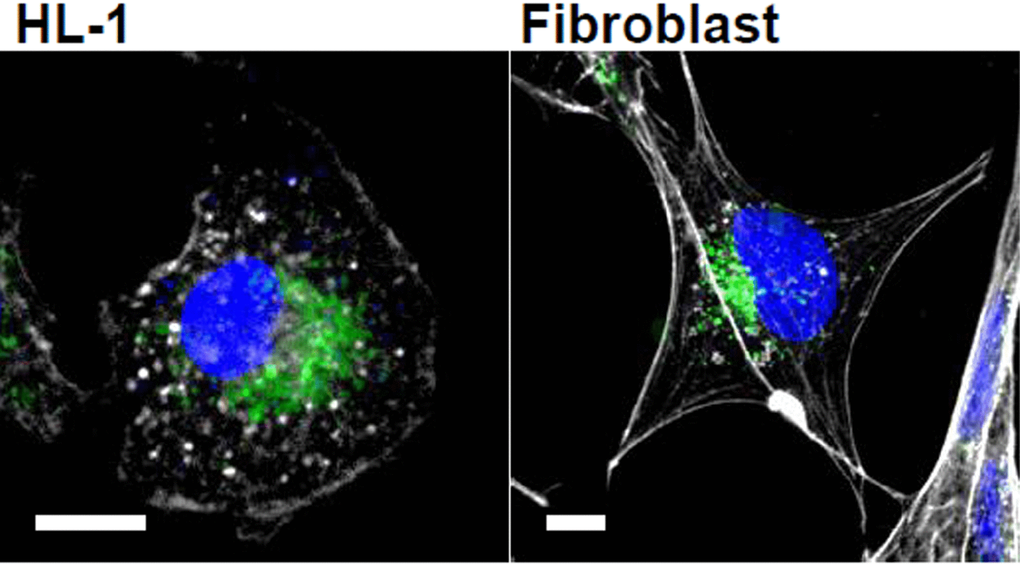 Microvesicles uptake into cardiomyocytes and fibroblasts. Cells were incubated with isolated and PKH67-labeled microvesicles (green) for 24 h. Actin is shown in white and nuclei in blue. Bar = 10 μm.