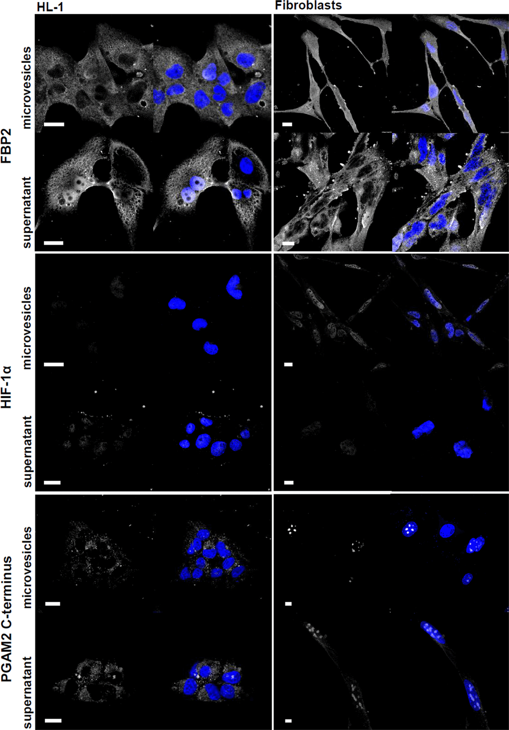 Microvesicle- and supernatant-induced changes in cardiomyocytes and fibroblasts. The studied proteins are shown in white, nuclei – in blue. Bar = 10 μm.