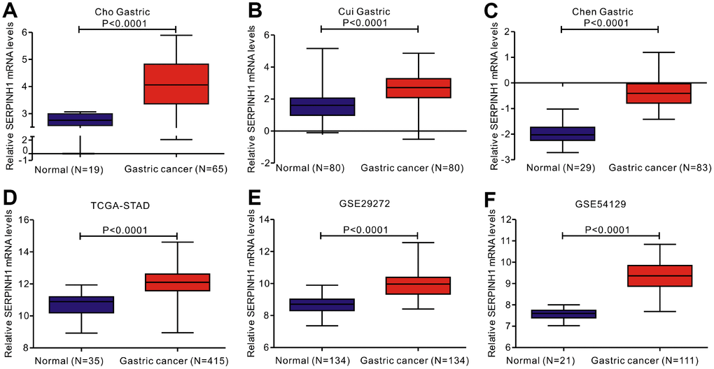 Analysis of SERPINH1 mRNA expression in normal and gastric cancer (GC) tissues from 3 public databases. SERPINH1 mRNA levels are significantly lower (PA) Cho (Normal=19; Tumor=65), (B) Cui (Normal=80; Tumor=80), and (C) Chen (Normal=29; Tumor=83) Gastric datasets from the Oncomine database; (D) STAD dataset (Normal=35; Tumor=415) from the TCGA database; and (E) GSE29272 (Normal=134; Tumor=134) and (F) GSE54129 (Normal=21; Tumor=111) datasets from the GEO databases.