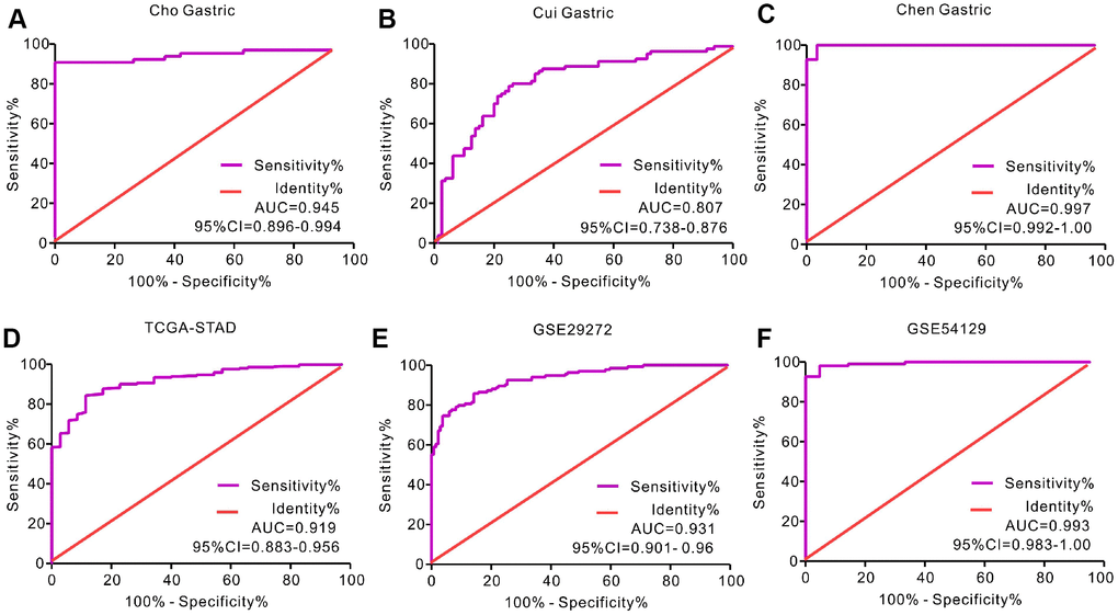 Receiver operating characteristic (ROC) curve analysis to determine diagnostic relevance of SERPINH1 mRNA levels in GC patients. ROC curve analysis of SERPINH1 mRNA levels in the (A) Cho (AUC=0.945), (B) Cui (AUC=0.807), and (C) Chen (AUC=0.997) Gastric datasets from the Oncomine database; (D) STAD dataset (AUC=0.919) from the TCGA database; and (E) GSE29272 (AUC=0.931) and (F) GSE54129 (AUC=0.993) datasets from the GEO databases.