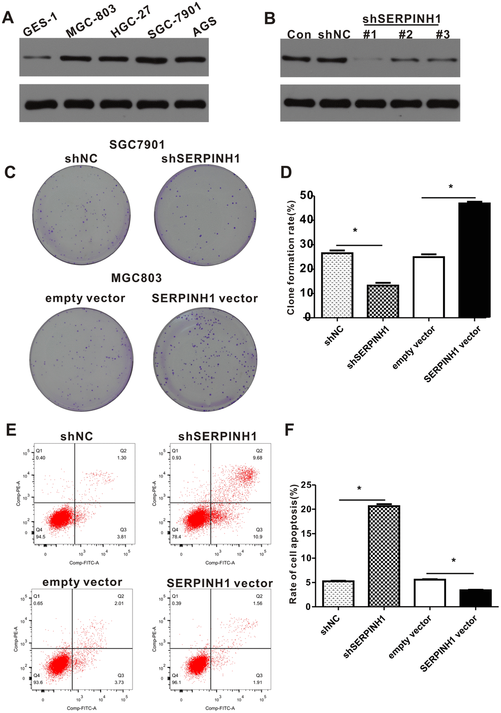 SERPINH1 expression regulates the proliferation and survival of GC cell lines. (A) Western blot analysis shows that SERPINH1 protein levels are higher in the four GC cell lines, HGC-27, AGS, MGC-803, SGC-7901, compared to the normal gastric mucosal cell line, GES-1. (B) Western blot analysis shows that SERPINH1 protein levels are significantly reduced in shSERPINH1 #1-transfected SGC-7901 cells compared with SGC-7901 cells transfected with shSERPINH1 #2, shSERPINH1 #2, and shNC. (C) Representative images of colonies in shSERPINH1#1-transfected SGC-7901 cells, SERPINH1-overexpression vector transfected MGC-803 cells, and their corresponding controls. (D) Histogram plots show the number of colonies in shSERPINH1#1-transfected SGC-7901 cells, SERPINH1-overexpression vector-transfected MGC-803 cells, and their corresponding controls. (E) Flow cytometry analysis shows that apoptotic rate is significantly higher in the shSERPINH1#1-transfected SGC-7901 cells and significantly lower in the SERPINH1-overexpression vector-transfected MGC-803 cells compared to their corresponding controls. (F) Histogram plot shows the percentage of apoptotic cells in shNC-, and shSERPINH1#1-transfected SGC-7901 cell cultures, as well as, empty vector and SERPINH1-overexpression vector-transfected MGC-803 cells.