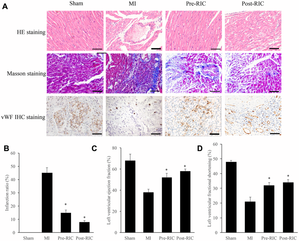 RIC remarkably promoted cardiac remodeling and angiogenesis after myocardial infarction. (A) Histopathological analysis of heart tissues by HE, Masson, vWF IHC staining, respectively (scale bar= 100 μm); (B) RIC treatment significantly decreased the infarction ratio; (C) RIC treatment significantly increased left ventricular ejection fraction; (D) RIC treatment significantly increased left ventricular fractional shortening. Data were shown as the mean ± SD (n = 5/each group), * P
