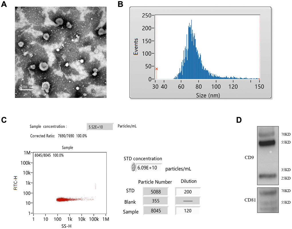 Isolation of exosomes from RIC rats. (A) Exosomes identification by TEM; (B) Measurement of exosomes particle size; (C) Measurement of exosomes concentration by flow cytometry; (D) Identification of CD9 and CD81 by western blotting.