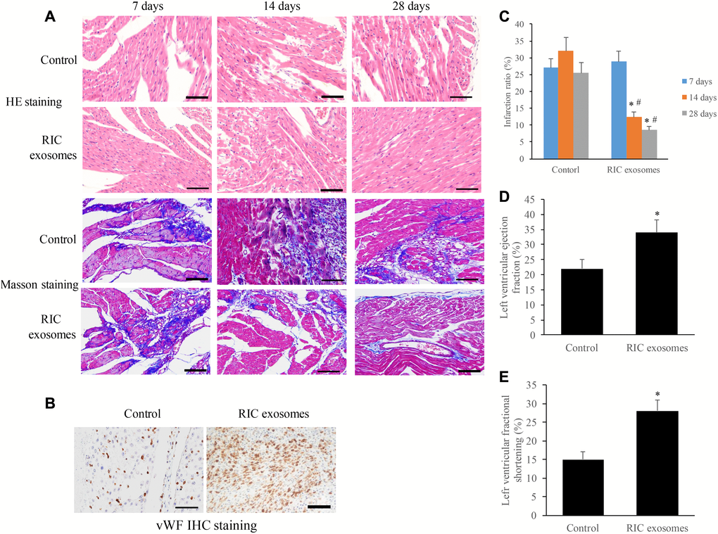 Exosomes from RIC rats significantly promoted cardiac remodeling and angiogenesis after myocardial infarction. (A) Histopathological analysis of heart tissues by HE and Masson (scale bar= 100 μm); (B) Investigation of angiogenesis after RIC exosomes treatment by vWf IHC staining (scale bar= 100 μm); (C) RIC exosomes treatment significantly decreased the infarction ratio; (D) RIC treatment significantly elevated left ventricular ejection fraction; (E) RIC treatment significantly promoted left ventricular fractional shortening. Data were shown as the mean ± SD (n = 3/each group), * P