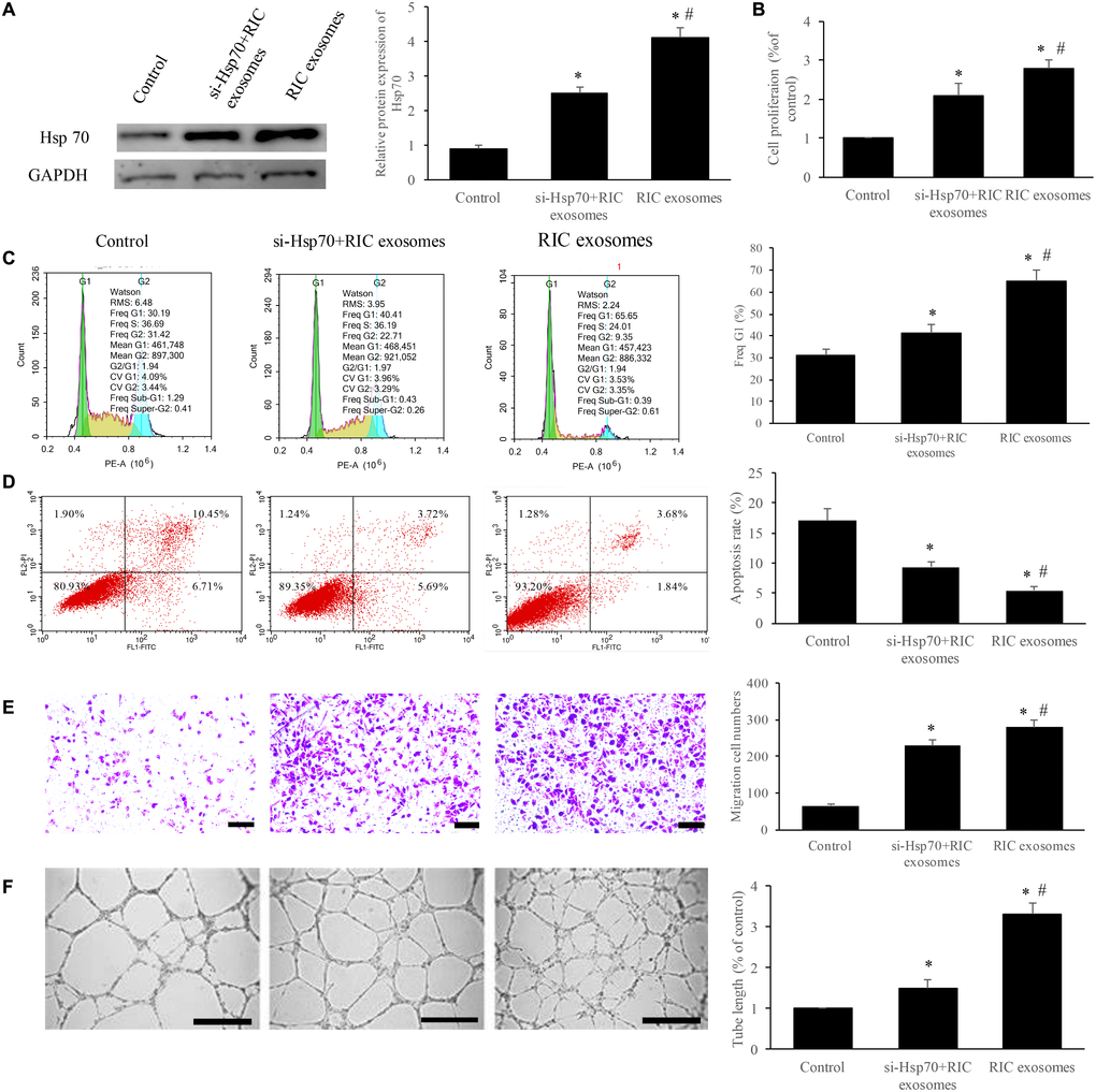 Exosomes from RIC markedly improved the cell viability and angiogenesis through promoting Hsp70. (A) RIC exosomes remarkably elevated the expression of Hsp70; (B) RIC exosomes significantly accelerated cell proliferation; (C) RIC exosomes remarkably increased the ratio of cell in G1 stage; (D) RIC exosomes significantly inhibited cell apoptosis; (E) RIC exosomes remarkably promoted cell migration (scale bar= 500 μm); (F) RIC exosomes significantly increased tube formation (scale bar= 500 μm). * P