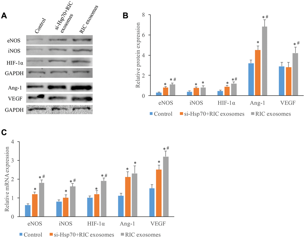 The expression increase of angiogenesis-related molecules after incubation with exosomes through targeting Hsp70. (A) Western analysis of angiogenesis-related molecule after treatment with si-Hsp70 and RIC exosomes; (B) Protein quantitative analysis of angiogenesis-related molecule after treatment with si-Hsp70 and RIC exosomes; (C) mRNA expression of angiogenesis-related molecule after treatment with si-Hsp70 and RIC exosomes. * P