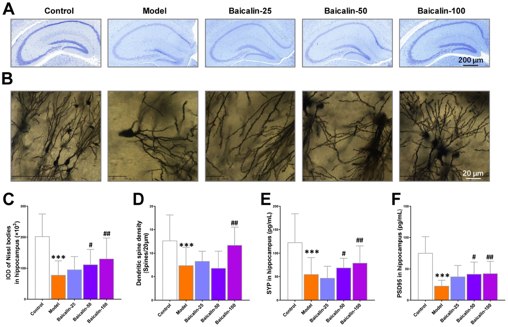 Baicalin improves hippocampal neuronal plasticity in repeated cerebral ischemia-reperfusion model mice. (A, B) Representative confocal microscopic images show (A) Nissl-stained and (B) golgi-stained hippocampal region of the brains of control, model, and Baicalin-treated model group mice. The brain tissue sections were subjected to Nissl and golgi staining, respectively. (C) The total number of Nissl bodies and (D) mean dendritic spine density of the hippocampal neurons based on the analysis of Nissl- and golgi-stained brain tissue sections of control, model, and Baicalin-treated model group mice are shown. (E, F) Representative images show immunohistochemical staining of (E) synaptophysin and (F) PSD95 proteins in the hippocampal region of control, model, and Baicalin-treated model group mice are shown. Note: *** denotes Pt-tests; # denotes P## denotes P