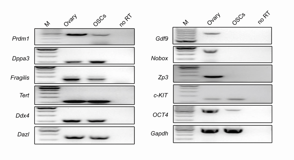 Morphology and characteristics of OSCs. (E) Reverse transcription PCR analysis for the expression profile of OSCs using ovarian tissue as a positive control. M: 100 bp DNA marker; No RT, PCR of RNA sample without reverse transcriptase.