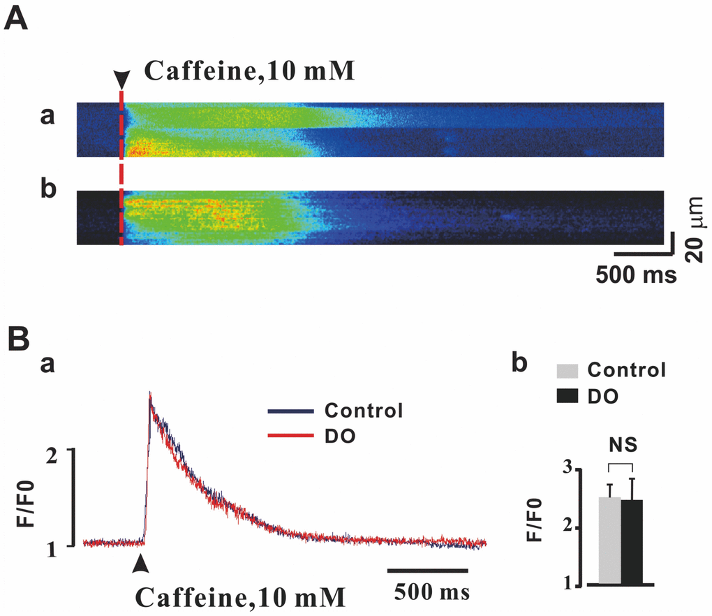 Unaltered SR Ca2+ load in detrusor myocytes of DO model rats. (A) Representative linescan images during 10 mM caffeine application in control (a) and DO (b) myocytes. (B) Peak amplitude of the caffeine-evoked fluorescence [Ca2+] i transient was not found to have been significantly different between DO afflicted and unafflicted control myocytes. We used unpaired t tests for comparisons between treatment groups. NS=Not significant.