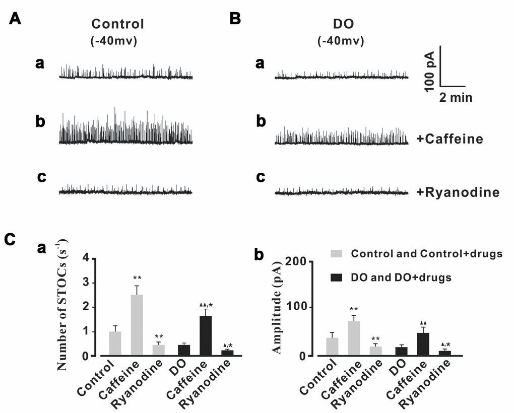 STOCs were increased by caffeine and decreased by ryanodine in both control and DO myocytes. (A, B) We recorded representative STOCs for control (A) and DO (B) detrusor myocytes before and after exposure to 10 μM caffeine (b) and before and after exposure to 10 μM ryanodine (c). Panels Ca and Cb provide summary data for frequencies and amplitudes of STOCs in unafflicted control and DO detrusor myocytes with regards to applications of caffeine (10 μM) and ryanodine (10 μM) (respectively). To record measures for STOCs, we clamped detrusor myocytes at -40 mV. We used one-way ANOVA for comparison between groups. VS control, *P 