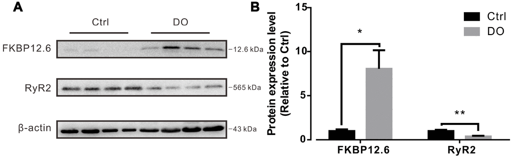 Decreased expression of ryanodine receptor-2 (RyR2) and increased expression of FKBP12.6 in detrusors of rats with DO. (A) Representative results from Western blotting analyses of RyR2, FKBP12.6, and GADPH (used as an internal control) from detrusors of unafflicted control rats and from DO afflicted rats. (B) Summarizations of levels of expression of RyR2 and FKBP12.6 proteins, given as ratios to beta actin. We used one-way ANOVA for comparisons between treatment groups. VS control, *P 