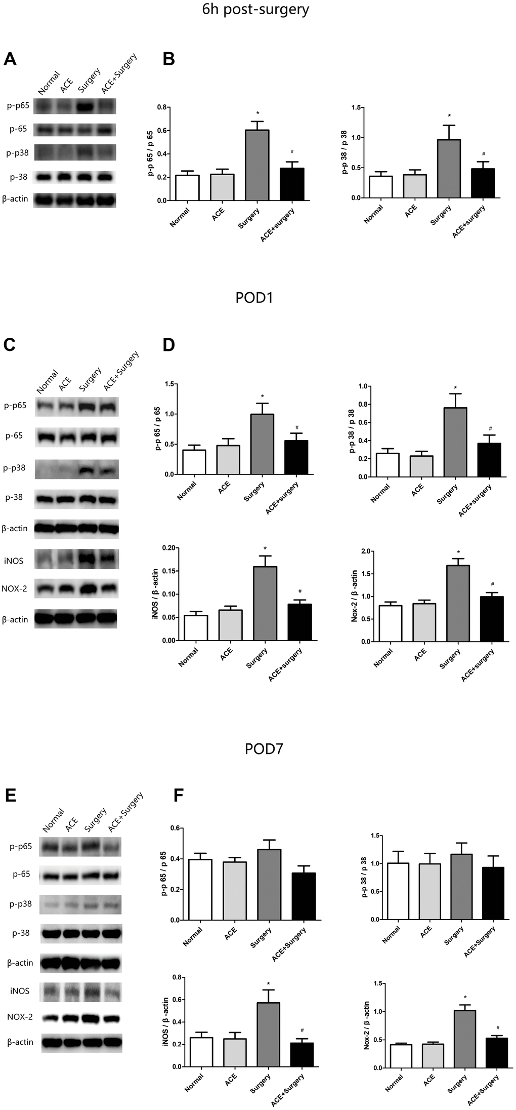 Changes in inflammatory signaling pathways and oxidative stress markers (n=8). (A) Representative bands display p-p65 and p-p38 protein levels 6 h post-surgery. (B) Bar graphs depict the relative quantification of p-p65/p65 and p-p38/p38. (C) Representative bands display p-p65, p-p38, iNOS and NOX2 protein levels on POD 1. (D) Bar graphs depict the relative quantification of p-p65/p65, p-p38/p38, iNOS/β-actin and NOX2/β-actin on POD 1. (E) Representative bands display the protein levels of the above indicators on POD 7. (F) Bar graphs depict the relative quantification of these indicators on POD 7. Data are expressed as the mean±SEM, *P