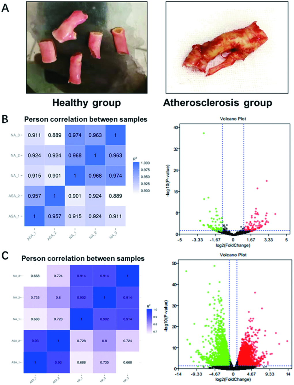 Photos of collected samples and RNA-sequencing analysis of differentially expressed miRNAs and mRNAs in atherosclerosis. (A) The normal carotid artery from patients with accident (Healthy group) and atherosclerotic plaque collected from patients with atherosclerosis (Atherosclerosis) were photo’d by cellphone. (B) The heat map (Left panel) and volcano plot (Right panel) of differentially expressed miRNAs and (C) mRNAs in atherosclerosis by RNA-sequencing. Red plots stand for upregulated genes and green ones represent downregulated genes with absolute log2FC>1 and P 