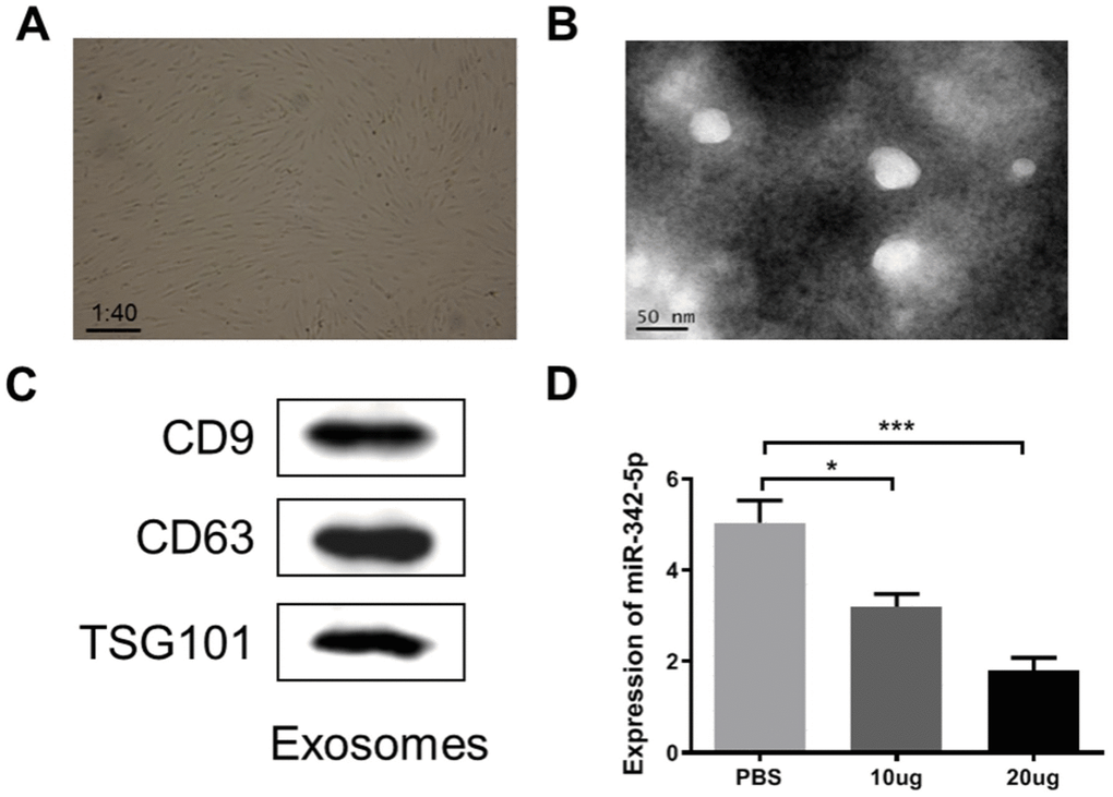 ADSCs-derived exosome was characterized and constrained the expression of miR-342-5p in HUVECs impaired by H2O2. (A) The spindle-like ADSCs were observed through the microscope at a magnification of ×40. (B) TEM analysis presented that exosomes were round membrane-bound vesicles with 30 to 150 nm diameter. Scale bar indicates 50 nm. (C) The common marker proteins for exosomes, CD9, CD63 and TGS101, were determined by western blot assay. (D) The expression level of miR-342-5p was subsequently detected by qRT-PCR assay after added the obtained exosomes at a mass of 10 ug or 20 ug into HUVECs impaired by H2O2 at a concentration of 1500 uM. *, PP