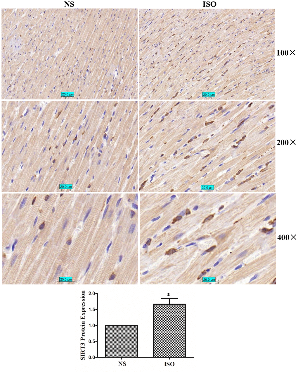 SIRT3 protein immunohistochemistry in rat heart tissues of NS group and ISO group. SD rats of ISO group were subjected to subcutaneous injections of 1.5 mg/kg/d isoproterenol for 7 d. The control group was given the same dose of saline. We stained SIRT3 protein with SIRT3 antibody and stained the nuclear with DAPI. Brown represents SIRT3 protein and blue represents nuclear. Representative images out of 4 independent experiments were shown.