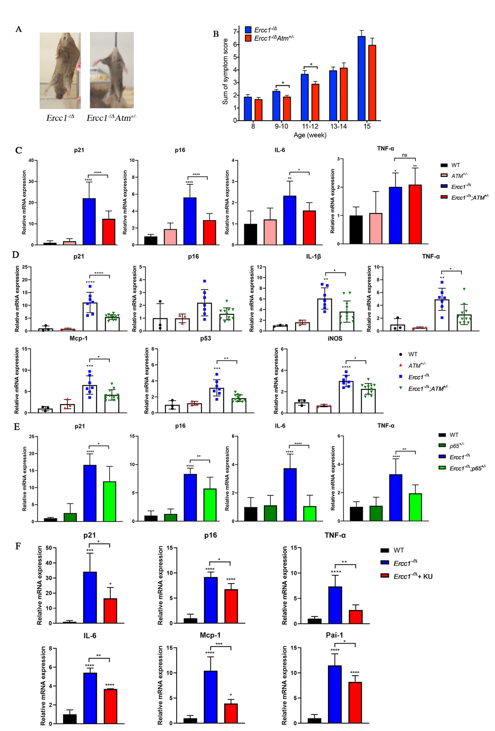 Genetic reduction of Atm attenuates aging phenotypes and reduces cellular senescence in vivo. (A) Representative images (left panel) of 15-week-old Ercc1-/Δ and Ercc1-/ΔAtm+/- mice illustrating the severity of their dystonia. (B) The composite score of aging symptoms (right panel) was plotted at the indicated ages. n=8-10 mice per group. (C) qRT-PCR analysis of mRNA expression in liver from 12-week-old WT, Atm+/-, Ercc1-/Δ and Ercc1-/ΔAtm+/- mice. n=3-6 per group. (D) qRT-PCR analysis of mRNA expression in quadriceps from 12-week-old WT, Atm+/-, Ercc1-/Δ and Ercc1-/ΔAtm+/- mice. n=3-11 per group. (E) qRT-PCR analysis of mRNA expression in liver from 10 to 12-week-old WT, p65+/-, Ercc1-/Δ and Ercc1-/Δp65+/- mice. n=4-5 per group. (F) mRNA expression of senescence markers in the liver of 12-week-old Ercc1-/Δ mice treated with 10 mg/kg of KU-55933 intraperitoneally 3 times per week for two weeks. n = 3 per group. Graphs represent mean+/- s.e.m. P value was determined using Student’s t-test. *p