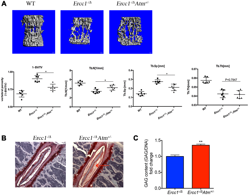 Genetic reduction of Atm improves bone and intervertebral disc pathology in progeroid Ercc1-/Δ mice. (A) Representative micro-CT images of lumber spines comparing severity of osteoporosis in 16-week-old WT, Ercc1-/Δ, Ercc1-/ΔAtm+/- mice. n=3-5 per group. Quantification of vertebral porosity, trabecular number, trabecular separation, thickness of trabecular bone was performed and shown. (B) Safranin O staining for disc matrix in thoracic discs from 12-week-old Ercc1-/Δ and Ercc1-/ΔAtm+/- mice. (C) GAG content measured by DMMB assays with NP tissues isolated from 12-week-old lumber discs. n=3 each group. Mean+/- s.e.m. P value was determined using Student’s t-test. **p