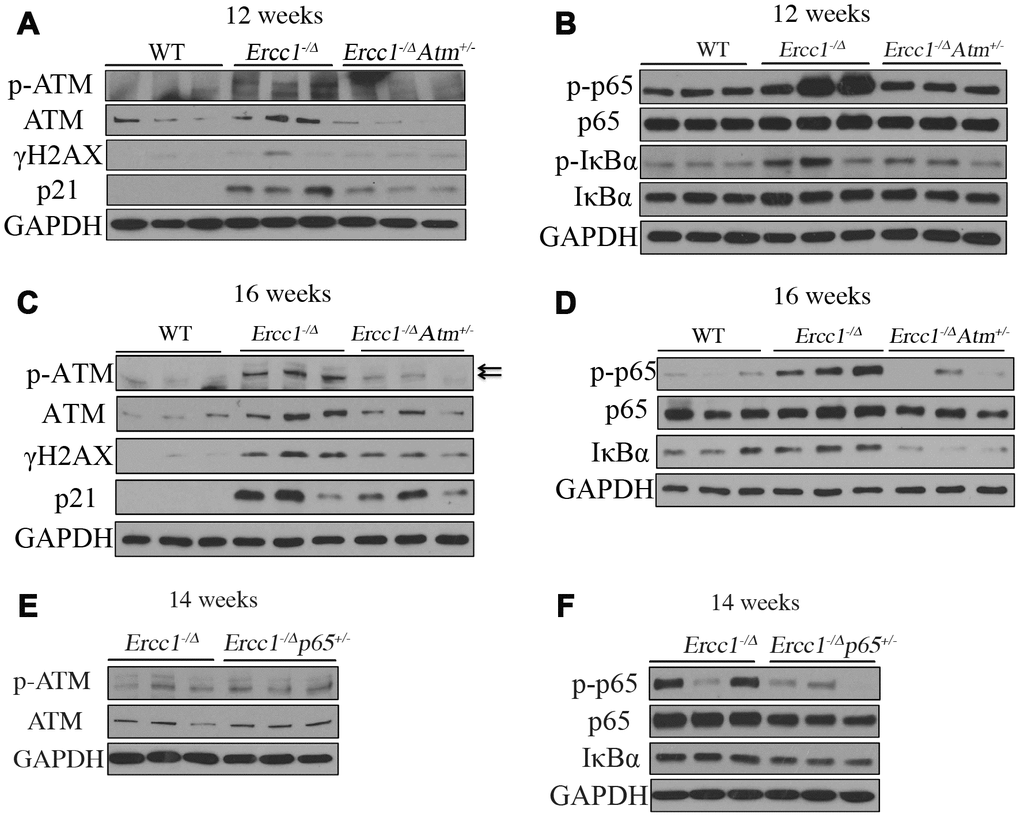 ATM and NF-κB activation are downregulated in Ercc1-/Δ mice heterozygous for Atm. (A) Livers were collected at 12 weeks of age from WT, Ercc1-/Δ and Ercc1-/ΔAtm+/- mic (n=3 per genotype) and lysates analyzed by western blot for activation of ATM and its downstream effectors. (B) Same liver lysates were used to measure phosphorylation of p65 and IκBα. (C) Western blot analysis of livers from 16-week-old WT, Ercc1-/Δ and Ercc1-/ΔAtm+/-mice (n=3 per genotype) probed for activation of ATM. GAPDH was used as a loading control. (D) Same liver lysates used to measure activation of NF-κB. (E) Fourteen-week-old livers from Ercc1-/Δ and Ercc1-/Δp65+/- mice (n=3 per genotype) were analyzed by western blot for activation of ATM (F) and NF-κB.