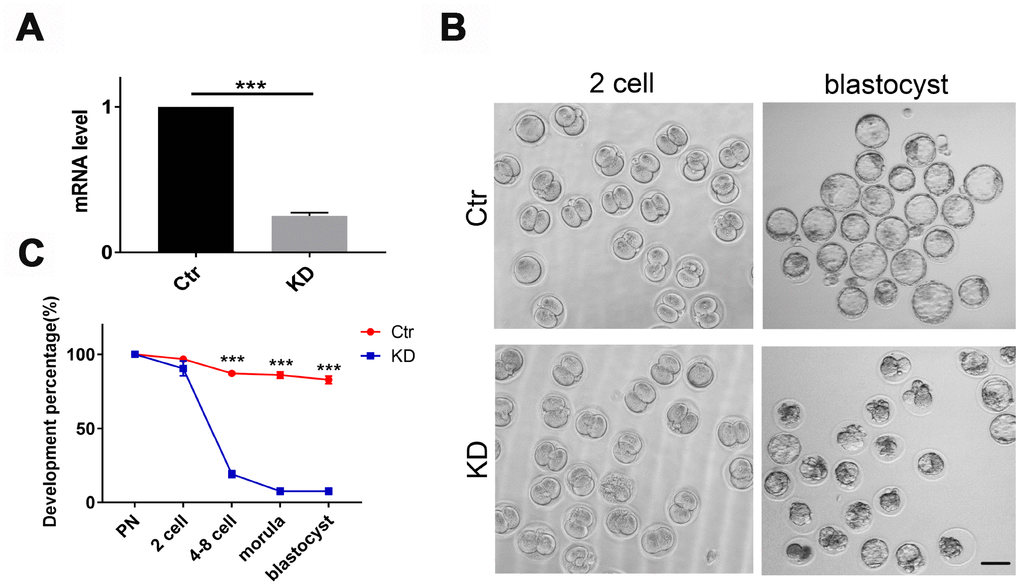 Depletion of TOP2B in mouse matured oocytes led to early embryo arrest at the 2-cell stage. (A) TOP2B knockdown efficiency in young mouse MII oocytes was assessed by qRT-PCR. Paired two-tailed Student’s t-test. (B) Representative images of mouse early embryos knocking down TOP2B mRNA. Bars = 100μm. (C) Knocking down TOP2B significantly reduces the developmental rate of early embryos (n=35,35,35). Paired two-tailed Student’s t-test.