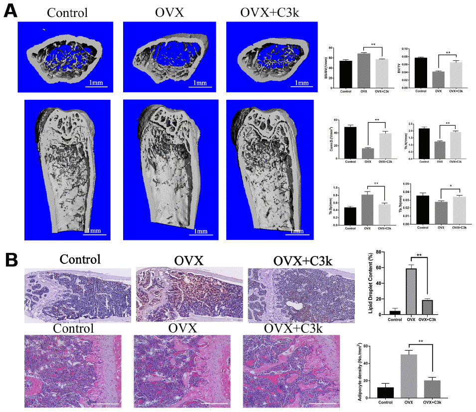C3k inhibits bone loss and adipogenesis in OVX mice. (A) Micro-CT images of the distal femoral metaphyseal region from the Control, OVX, and OVX + C3k groups. Histograms represent the trabecular structural parameters of the distal femur: bone surface/trabecular bone volume (BS/BV), trabecular bone volume/tissue volume (BV/TV), connectivity density (Conn.D), trabecular number (Tb.N), trabecular thickness (Tb.Th) and trabecular separation (Tb.Sp). (B) H&E staining and Oil Red O staining of distal femoral sections of Control, OVX, and OVX + C3k groups. Scale bar represents 400 μm. Data are presented as means ± SD. n = 10. *P 