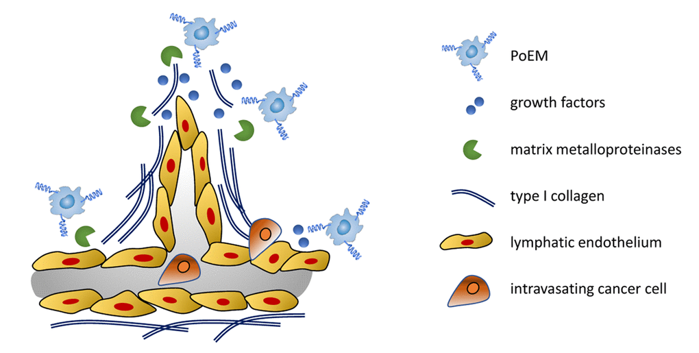 In breast cancer, PoEMs migrate towards the lymphatic endothelium. In this niche, they stimulate lymphangiogenesis by means of matrix remodeling resulting in the accessibility of growth factors. Moreover, Collagen I synthetized by PoEMs constitutes a scaffold for growing lymphatics. Directly and indirectly, matrix remodeling by PoEMs also fuels cancer cell lymphoinvasion.
