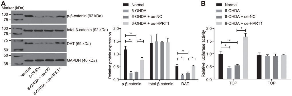Overexpressed HPRT1 activates the Wnt/β-catenin signaling pathway in a PD model. 6-OHDA-treated N27 dopaminergic neurons were treated with oe-NC or oe-HPRT1. (A) The protein expression of total-β-catenin and DAT as well as the extent of β-catenin phosphorylation in the N27 dopaminergic neurons detected by western blot assay. (B) The activity of the Wnt/β-catenin signaling pathway expressed by TOP/FOP ratio using TOP/FOP flash reporter assay. FOP was designated as background value or as negative control due to its stability. *p t test.