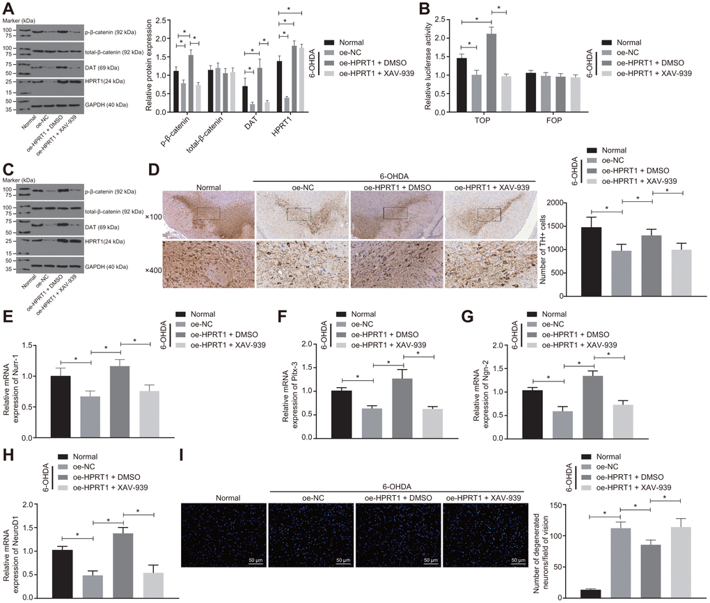 Overexpressed HPRT1 inhibits dopaminergic neuron loss via the Wnt/β-catenin signaling pathway in 6-OHDA-treated N27 dopaminergic neurons and mice. N27 dopaminergic neurons and mice were treated with oe-HPRT1 in the presence of the Wnt/β-catenin blocker XAV-939 or DMSO carrier. (A) The protein expression of total-β-catenin, DAT and HPRT1 as well as the extent of β-catenin phosphorylation in the N27 dopaminergic neurons detected by western blot assay. (B) The activity of the Wnt/β-catenin signaling pathway expressed by TOP/FOP ratio in the N27 dopaminergic neurons. FOP was designated as background value or as negative control due to its stability. (C) The protein expression of total-β-catenin, DAT and HPRT1 as well as the extent of β-catenin phosphorylation in the normal and 6-OHDA-lesioned PD mice. (D) TH positive neurons in the substantia nigra tissues examined by immunohistochemistry (upper × 100, lower × 400). (E–H) The mRNA expression of Nurr-1 (E), Pitx-3 (F), Ngn-2 (G) and NeuroD1 (H) in the substantia nigra tissues examined by RT-qPCR. (I) Fluoro-Jade B-stained apoptotic N27 dopaminergic neurons (scale bar = 50 μm). *p t test, and comparison among multiple groups by one-way analysis of variance. n = 6.