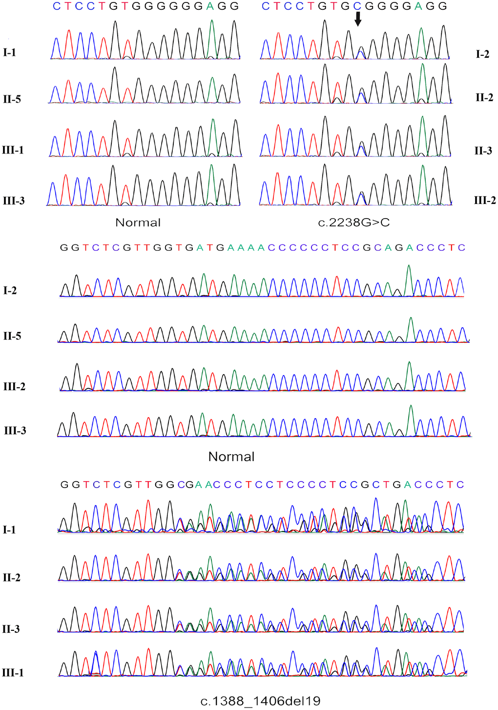 Sanger sequencing verification of the c.2238G>C mutation and frameshift mutation c.1388