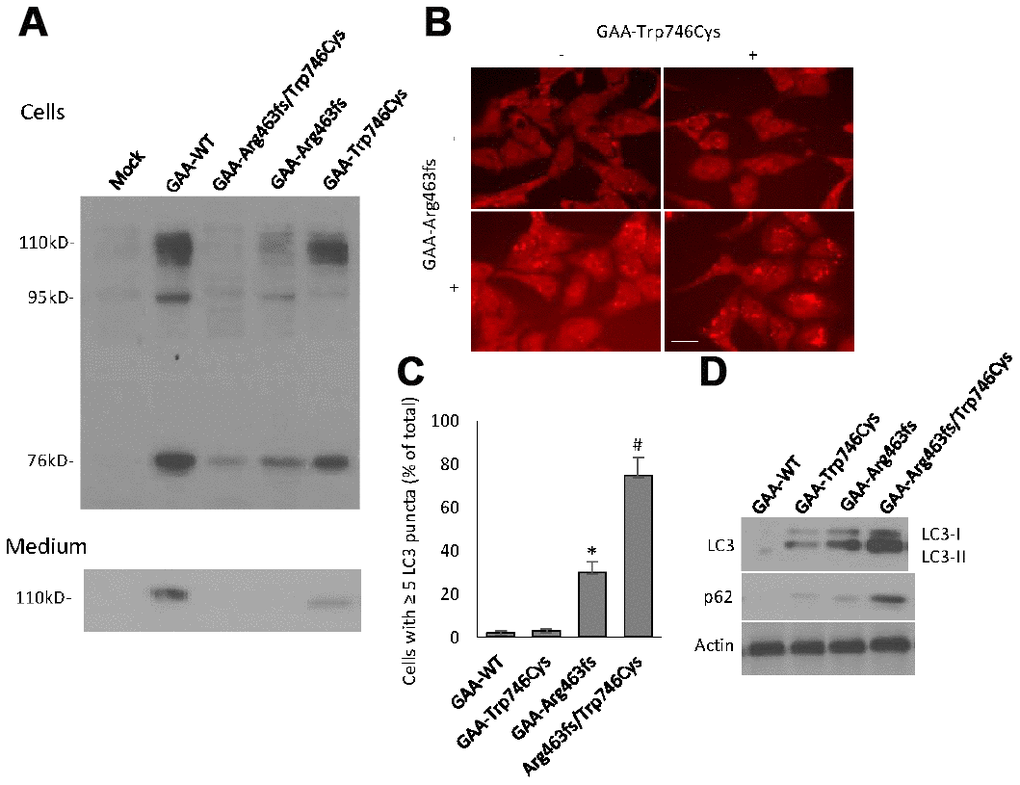 GAA expression and autophagy induction in transiently expressed HEK293 cells. (A) Western blot analysis of GAA protein expression in cells and culture medium that were harvested at 48 hour after transfection. Different molecular forms of GAA protein, i.e., 110kD precursor, 95 kD partially processed intermediate and 76 kD mature GAA were separated by SDS-PAGE and visualized by immunoblotting. Top panel: cell lysates; bottom panel: culture media. (B) Representative immunofluorescent images of the LC3-positive autophagic puncta in HEK293 cells with different transfection. Scale bar: 10μm. (C) Quantification of the % of cells contains ≥ 5 LC3 puncta. (D) Western blot analysis of LC3 and p62 in transfected cells.