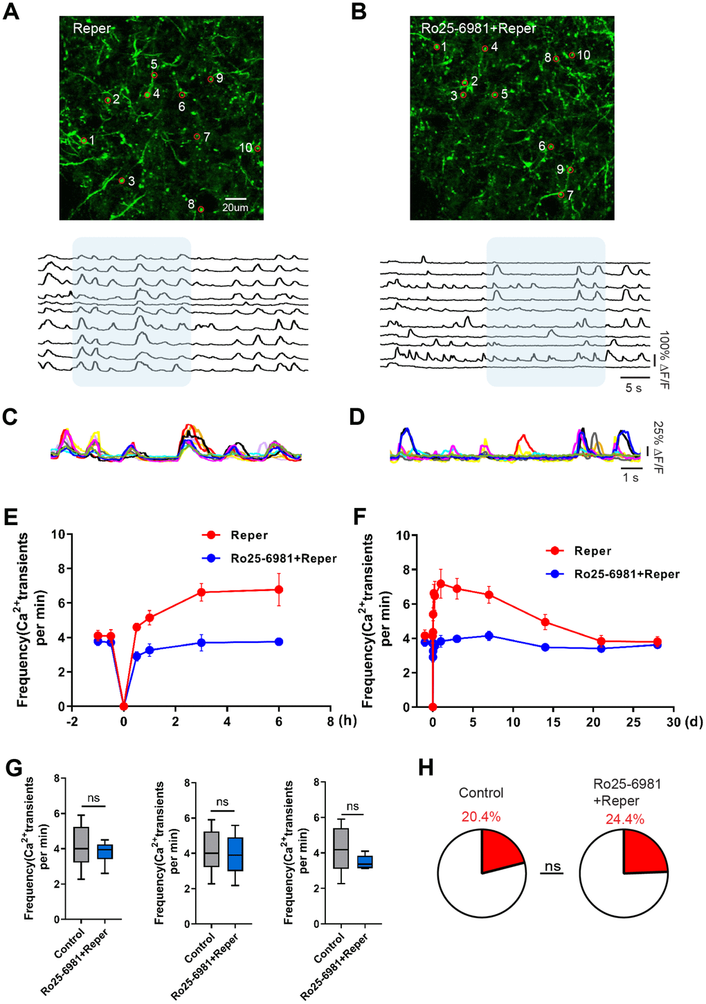 Transient global cerebral ischemia-reperfusion aggravates NMDAR-dependent spine dysfunction. (A, B) Top, layer 1 (30~50 um) spines images on the 3rd day after reperfusion, where the red circle represents the selected spine in Reper (A) and Ro25-6981-treated (B) mice. Bottom, the traces of selected spines. (C, D) Superimposed traces from the shaded areas in a and b. Each color represents a different cell. (E, F) The overall trend of the average frequency of Ca2+ transients before and after 6 hours (E) and 28 days (F) of ischemia-reperfusion. (G) The average frequency of Ca2+ transients in Reper and Ro25-698-treated mice. The 3rd hour (left, n= 438 spines in 6 Reper mice, n= 312 spines in 4 Ro25-698-treated mice), the 3rd day (middle, n= 432 spines in 6 Reper mice, n= 328 spines in 4 Ro25-698-treated mice) and the 14th day (right, n=436 spines in 6 Reper mice, n= 329 spines in 4 Ro25-6981-treated mice). (H) The fractions of hyperactive spines Reper mice (n= 432 spines) and Ro25-698-treated mice (n=328 spines) on the 3rd day after reperfusion. *P 