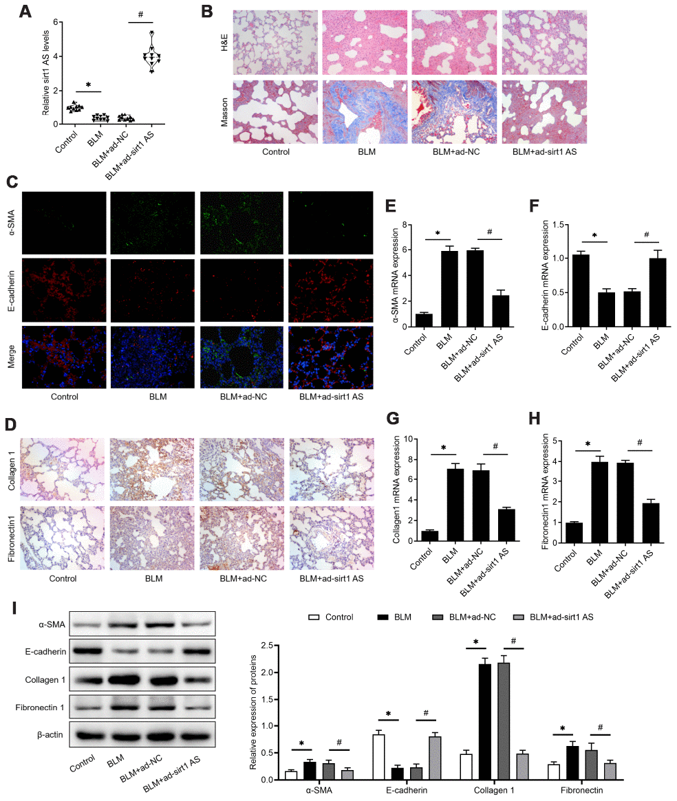 lncRNA sirt1 antisense (AS) alleviates bleomycin (BLM)-induced pulmonary fibrosis. (A) The expression of sirt1 AS in the pulmonary tissues from control mice or bleomycin (BLM) treated mice that treated with adenovirus sirt1 AS and ad-NC (n=10 per group). (B) H&E and Masson’s trichrome staining showed pulmonary injury and collagen deposition of pulmonary tissues in mice with or without sirt1 AS overexpression. (C) Immunofluorescence staining showing the overlap of E-cadherin (red) and a-SMA (green) in pulmonary tissues with or without sirt1 AS overexpression. (D) Immunohistochemistry analysis indicated the accumulation of collagen 1 and fibronectin 1 in the lung with or without sirt1 AS overexpression. (E–H) QPCR analysis demonstrated the expression of epithelial-mesenchymal transition (EMT)-related markers, α-SMA, E-cadherin, Collagen 1 and Fibronectin1 mRNA in indicated groups (n=10 per group). (I) Western blot showed the relative expression of EMT related markers α-SMA, E-cadherin, collagen1 and fibronectin1 from mice with or without overexpression of sirt1 AS up bleomycin (BLM) treatment; and densitometry quantified data of above indicated markers, represented as a fold change to β-actin. * P