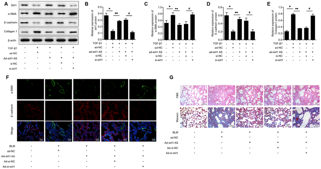 Sirt1 is involved in the anti-fibrosis function of lncRNA sirt1 antisense (AS). (A–E) Western blot assay and quantitative analyses of sirt1 protein levels in RLE-6TN cells transfected with ad-NC, ad-sirt1 AS, ad-sirt1 AS+si-NC, ad-sirt1 AS+si-sirt1 under TGF-β1 treatment. (F) Immunofluorescence staining showing the overlap of E-cadherin (red) and α-SMA (green) in pulmonary tissues from mice intratracheally infected with ad-NC, ad-sirt1 AS, ad-sirt1 AS+ad-si-NC, ad-sirt1 AS+ad-si-sirt1. (G) H&E and Masson’s trichrome staining showed pulmonary injury and collagen deposition of pulmonary tissues in mice with above indicated treatment. * P