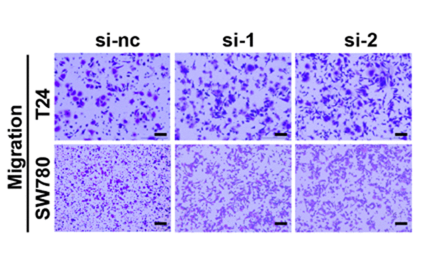 Silencing circ5912 promotes bladder cancer cell growth and metastasis in vitro. (I) migration and invasion were assessed by counting cells that were able to penetrate the trans-well membrane, scale bar: 25μm.