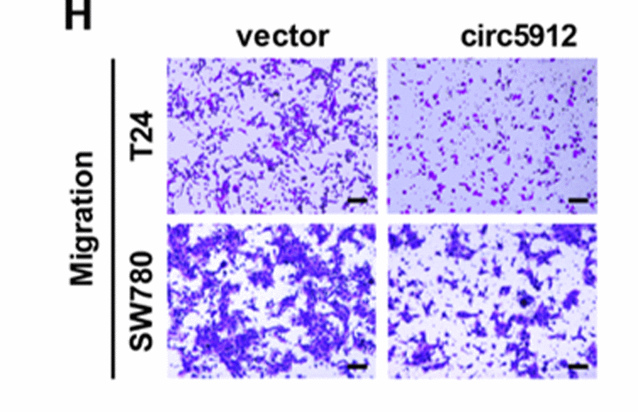 Overexpression of circ5912 suppresses bladder cancer growth and metastasis. (H) migration and invasion were assessed by counting cells that penetrated the trans-well membrane, scale bar: 25μm.