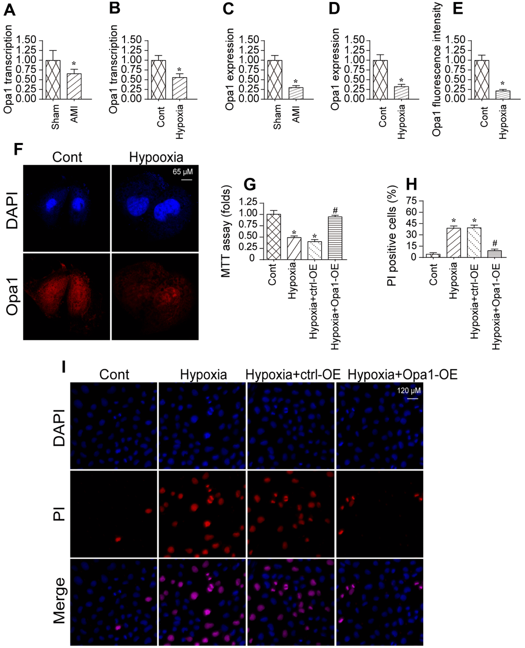 Opa1 is downregulated in the infarcted heart and in hypoxia-treated cardiomyocytes. (A–D) Quantitative real-time PCR and western blot analysis of Opa1 expression. (E, F) Analysis of Opa1 expression in cardiomyocytes in vitro by immunofluorescence. (G) MTT assays of cardiomyocyte viability. (H, I) Analysis of cardiomyocyte apoptosis by PI staining. *P 
