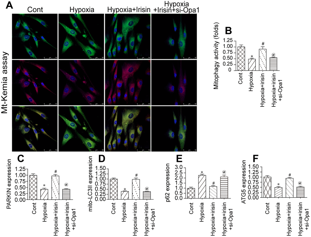 Irisin activates Opa1-induced mitophagy. (A, B) Flow cytometry analysis of mitophagy using the fluorescent probe mt-Keima. (C–F) Analysis of the expression of mitophagy-associated proteins by western blotting. *P 