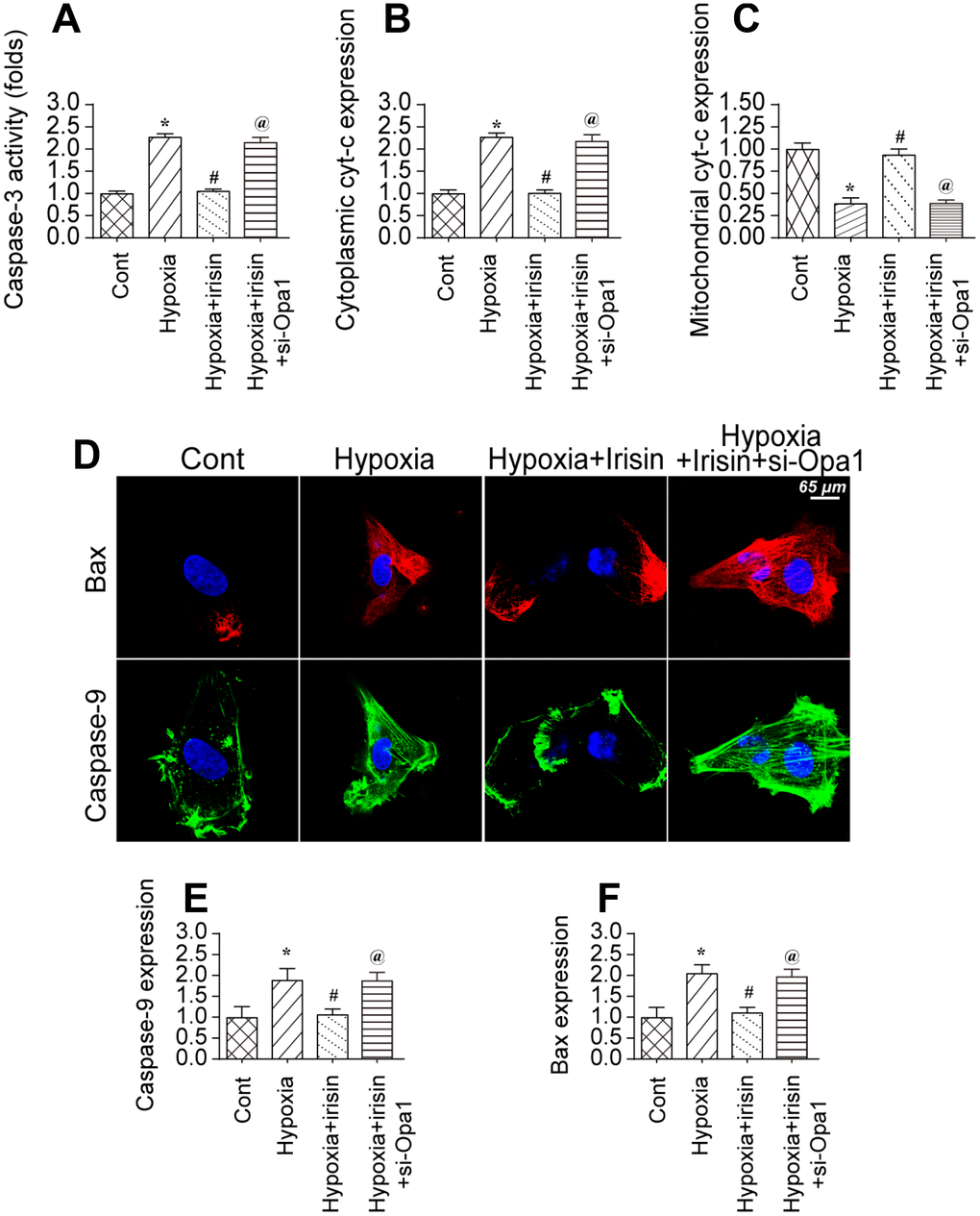 Opa1-induced mitophagy inhibits the mitochondrial apoptosis pathway. (A) Analysis of caspase-3 activity in cardiomyocytes by ELISA. (B, C) Western blot analysis of cyt-c levels in the cytoplasm and mitochondria. (D–F) Immunofluorescence analysis of Bax and caspase-9 expression in cardiomyocytes. *P 
