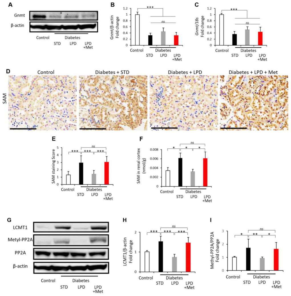 Changes in the renal Gnmt expression and SAM content. Representative western blots of Gnmt and β-actin in the renal cortex (A). Quantitative ratios of Gnmt to β-actin (B) and mRNA expression of Gnmt adjusted to 18S levels (C) in the renal cortex (n=7). Representative photographs of SAM immunohistochemistry of the kidney (scale bar: 100 μm) (D). Semiquantitation of the SAM staining scores (E) (n=3). SAM levels in the renal cortex (F) (n=3). Representative western blots of LCMT1, methylated-PP2A, PP2A and β-actin in the renal cortex (G). Quantitative ratios of LCMT1 to β-actin (H) and methylated-PP2A to PP2A (I) in the renal cortex (n=7). The data shown are the means ± SD. **pns: not significant. Gnmt: glycine-N-methyltransferase, SAM: S-adenosylmethionine, LCMT1: leucine carboxyl methyltransferase 1, PP2A: protein phosphatase 2A.