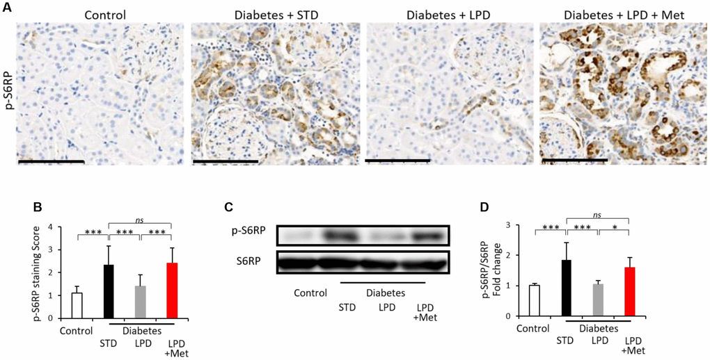 Changes in mTORC1 activity in the kidney. Representative photographs of immunohistochemistry for p-S6RP in tubular lesions (A) (scale bar: 100 μm). Semiquantitation of p-S6RP staining scores in tubulointerstitial lesions (B) (n=3). Representative western blots of p-S6RP and S6RP in the renal cortex (C). Quantitative ratios of p-S6RP to S6RP (D) (n=7). The data shown are the means ± SD. *pns: not significant. mTORC1: mechanistic target of rapamycin complex 1, S6RP: phospho-S6 ribosomal protein.