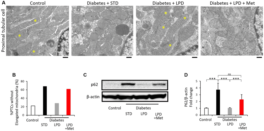 Morphology of mitochondria in PTCs and autophagy. Representative TEM images of PTCs (scale bar: 500 nm) (A). Asterisks indicate elongated (>2 μm) mitochondria (A). The ratio of PTCs without elongation of mitochondria to total PTCs (B) (from 3 animals). Representative western blots of p62 and β-actin expression (C) and the quantitative ratios of p62 to β-actin in the renal cortex (D) (n=7). The data shown are the means ± SD. **pns: not significant. PTCs: proximal tubular cells, TEM: transmission electron microscopy.