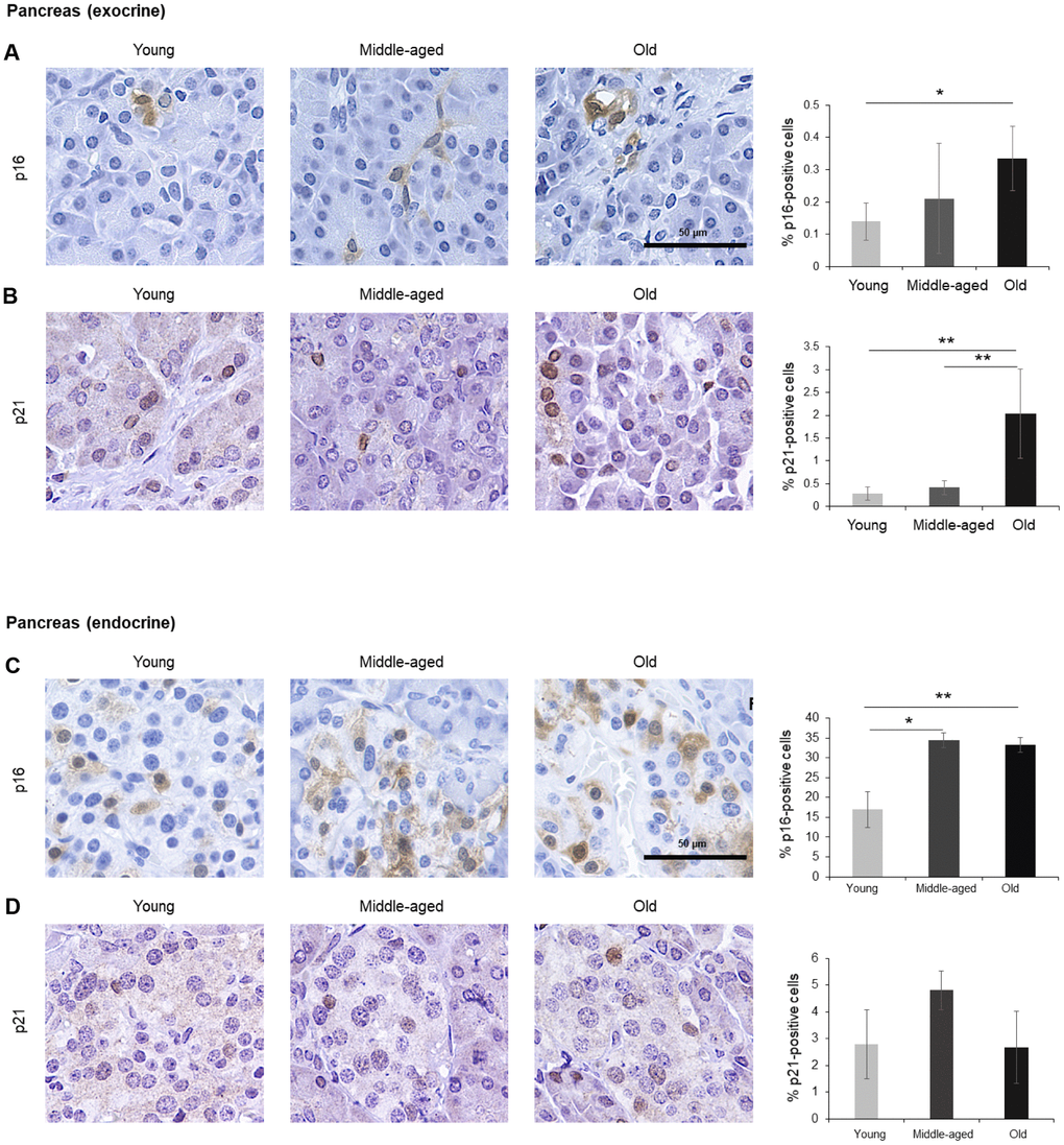 Pancreas. (A, B) Cells expressing p16 (A) or p21 (B) were identified by IHC staining in exocrine regions of the pancreas of Young, Middle-aged, and Old donors. (C, D) Cells expressing p16 (C) or p21 (D) were identified by IHC staining in the endocrine regions of the pancreas from Young, Middle-aged, and Old donors. Graphs represent the quantification (%) of p16-positive (A, C) and p21-positive (B, D) cells from 5 tissue cores from independent donors per organ and age group; data represent the means ±SD from 5 different donors. p values were determined by one-way ANOVA with Tukey adjustments for multiple comparisons where appropriate. **, p p 