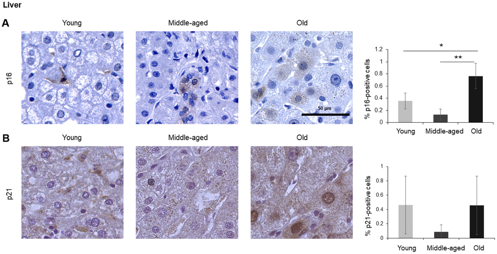 Liver. Cells expressing p16 (A) or p21 (B) were identified by IHC staining in the liver of Young, Middle-aged, and Old donors. Graphs represent the quantification (%) of p16-positive (A) and p21-positive (B) cells from 5 tissue cores from independent donors per organ and age group; data represent the means ±SD from 5 different donors. p values were determined by one-way ANOVA with Tukey adjustments for multiple comparisons where appropriate. **, p p 
