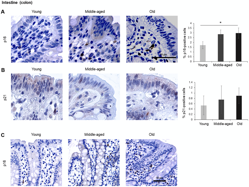 Intestine (colon). (A, B) Cells expressing p16 (A) or p21 (B) were identified by IHC staining in the colon of Young, Middle-aged, and Old donors. (C) p16-expressing cells in colon shown at lower magnification (20x). Graphs represent the quantification (%) of p16-positive (A) and p21-positive (B) cells from 5 tissue cores from independent donors per organ and age group; data represent the means ±SD from 5 different donors. p values were determined by one-way ANOVA with Tukey adjustments for multiple comparisons where appropriate. *, p 