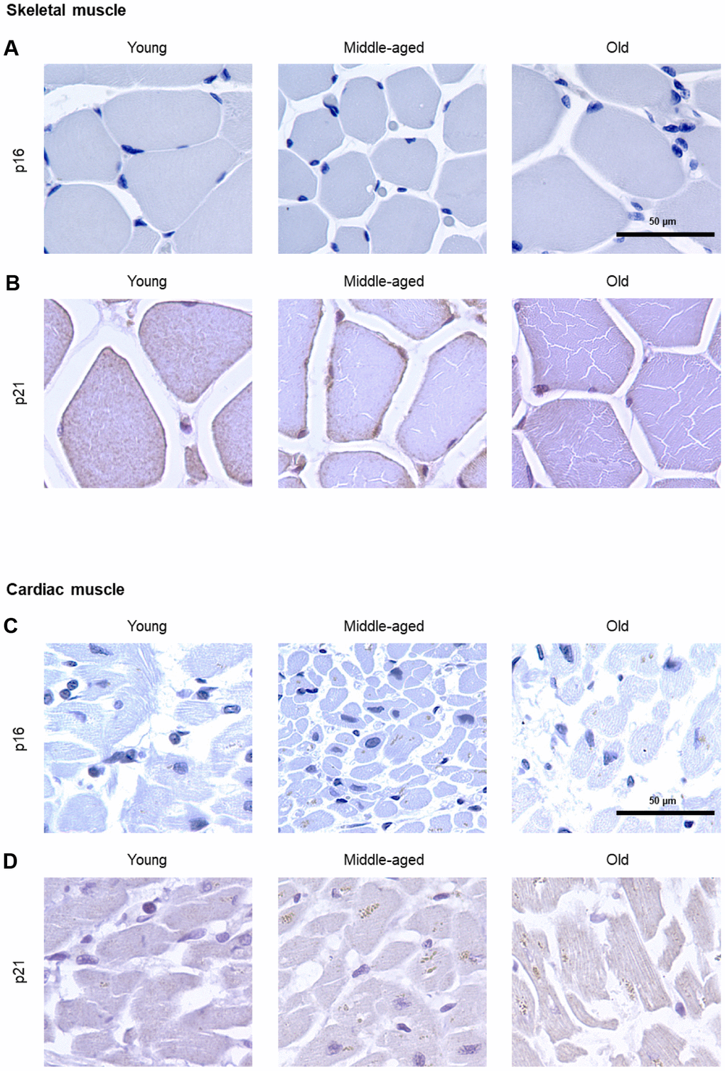 Muscle. IHC analysis to detect cells expressing p16 (A) or p21 (B) in skeletal muscle of Young, Middle-aged, and Old donors. IHC analysis to detect cells expressing p16 (C) or p21 (D) in cardiac muscle of Young, Middle-aged, and Old donors. These proteins were undetectable in these muscle biopsies (5 cores per organ and age group).