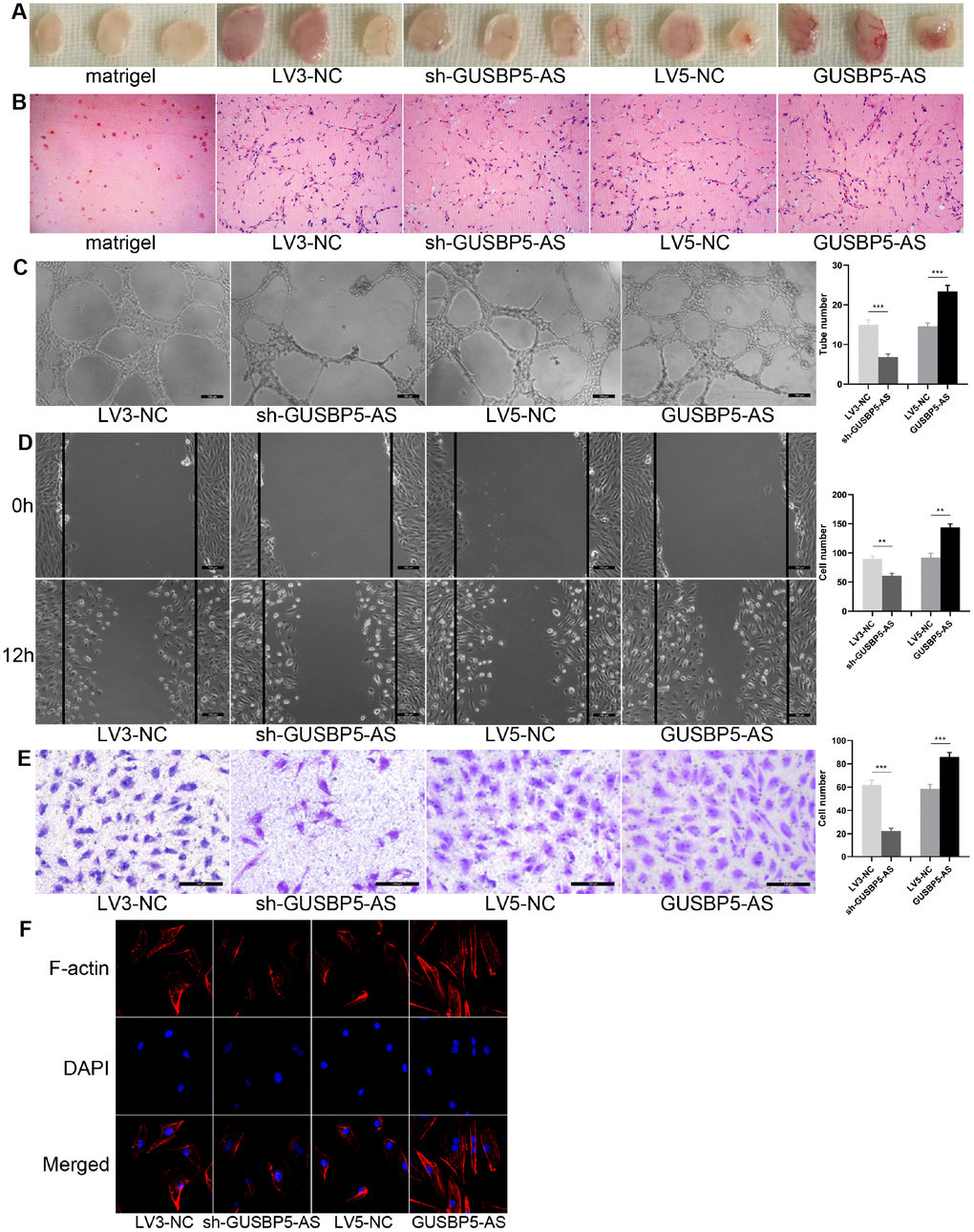 Effects of lncRNA GUSBP5-AS on angiogenesis of EPCs in vivo and in vitro, EPC migration and invasion. (A) In vivo angiogenesis was evaluated at Day 7 after subcutaneous injection of Matrigel-mixed EPCs into nude mice. (B) HE staining: lncRNA GUSBP5-AS knockdown and overexpression, respectively, decreased and increased tube formation by EPCs in vivo (original magnification, ×200). (C) In vitro tube formation assay. Scale bar=100μm. (original magnification, ×100). LncRNA GUSBP5-AS knockdown and overexpression, respectively, decreased and increased tube number. ***PD) Wound healing assay showing the effects of lncRNA GUSBP5-AS on EPC migration. Scale bar=100μm. (original magnification, ×100). LncRNA GUSBP5-AS knockdown and overexpression, respectively, decreased and increased cell migration in EPCs. **PE) Effects of lncRNA GUSBP5-AS on cell invasion ability were analysed. Scale bar=100μm. (original magnification, ×200). Data are represented as mean ± SEM. ***PF) Effect of lncRNA GUSBP5-AS on actin cytoskeleton structure in cultured EPCs. Cells were fixed, permeabilized, stained with rhodamine–phalloidin and DAPI, and visualized by confocal microscopy; down-regulation of GUSBP5-AS impaired F-actin while GUSBP5-AS overexpression prevented disruption of actin cytoskeletal structure.