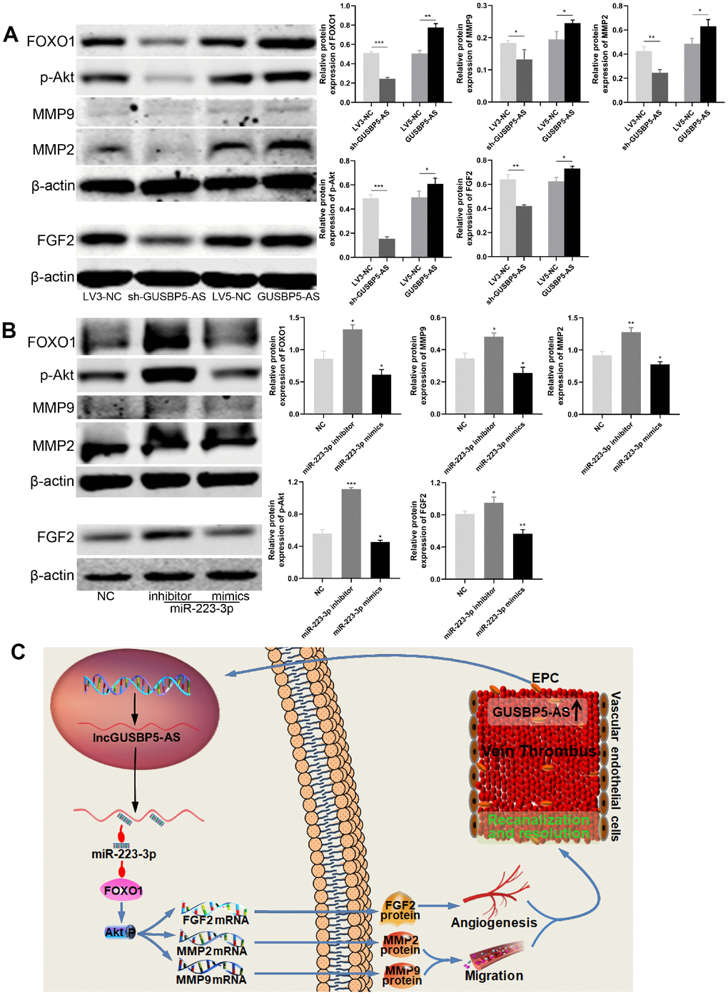 GUSBP5-AS regulates FGF2 and MMP2/9 expression through FOXO1/Akt pathway by sponging with miR-223-3p. (A) Effects of GUSBP5-AS on the regulation of the protein expression of FOXO1, p-Akt, MMP2, MMP9 and FGF2 in EPCs by western blot analysis. GUSBP5-AS knockdown and overexpression, respectively, reduced and increased these protein expression levels. (B) Western blot analysis of the protein expression levels of FOXO1, p-Akt, MMP2, MMP9 and FGF2 in EPCs after infected with NC, miR-223-3p inhibitor and mimics. The resulted showed that miR-223-3p inhibitor and mimics, respectively, promoted and inhibited these protein expression. *P C) Schematic of the role of GUSBP5-AS-mediated effects in EPCs. Red arrow indicates inhibition and blue arrow indicates promotion.